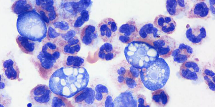 கேரளாவில் மூளையை தாக்கும் அமீபா கண்டுபிடிப்பு : மூன்று குழந்தைகள் தீவிர சிகிச்சையில்