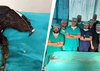 “பெற்றோர்களே குழந்தைகளை கவனிங்க” வலியில் துடித்த 14 வயது சிறுமி.! மிரண்டுபோன மருத்துவர்கள்