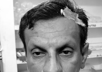 கிருஷ்ணகிரி : காவல் ஆய்வாளர் மீது கல்வீசி தாக்குதல் – மண்டையில் பலத்த காயம் ; 13 பேர் கைது