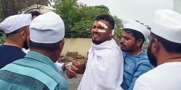 அகமதாபாத் விமான விபத்தில் உயிர் பிழைத்த ஒரே நபர் விஸ்வாஸ் குமார் – புதிய பிரச்சனையில் சிக்கிய அதிர்ச்சி !