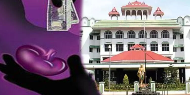 கிட்னி திருட்டு விவகாரம்: அரசு அறிக்கை தாக்கல் செய்ய உத்தரவிட்ட ஐகோர்ட்!