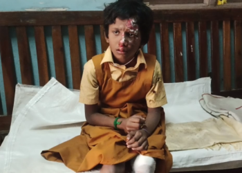 கால்டெக்ஸ் தெருநாய்கள் சண்டையிட்டுக்கொண்டு 9வயது மாணவிகள் 2மாணவிகளின் பெற்றோர் 4 பேருக்கு காயம், நாய் உயிரிழப்பு